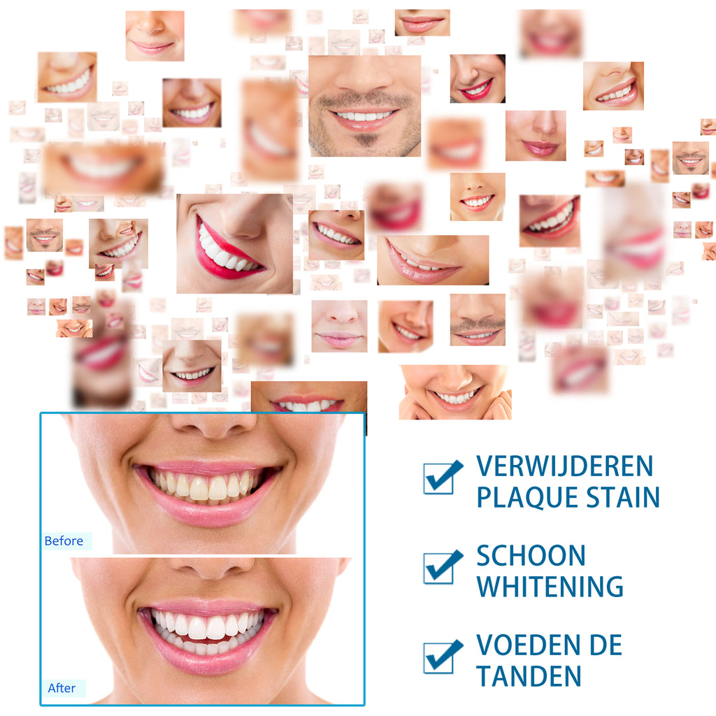 Tooth Whitening Pen